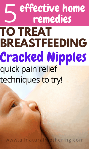 home remedies to treat cracked nipples while breastfeeding